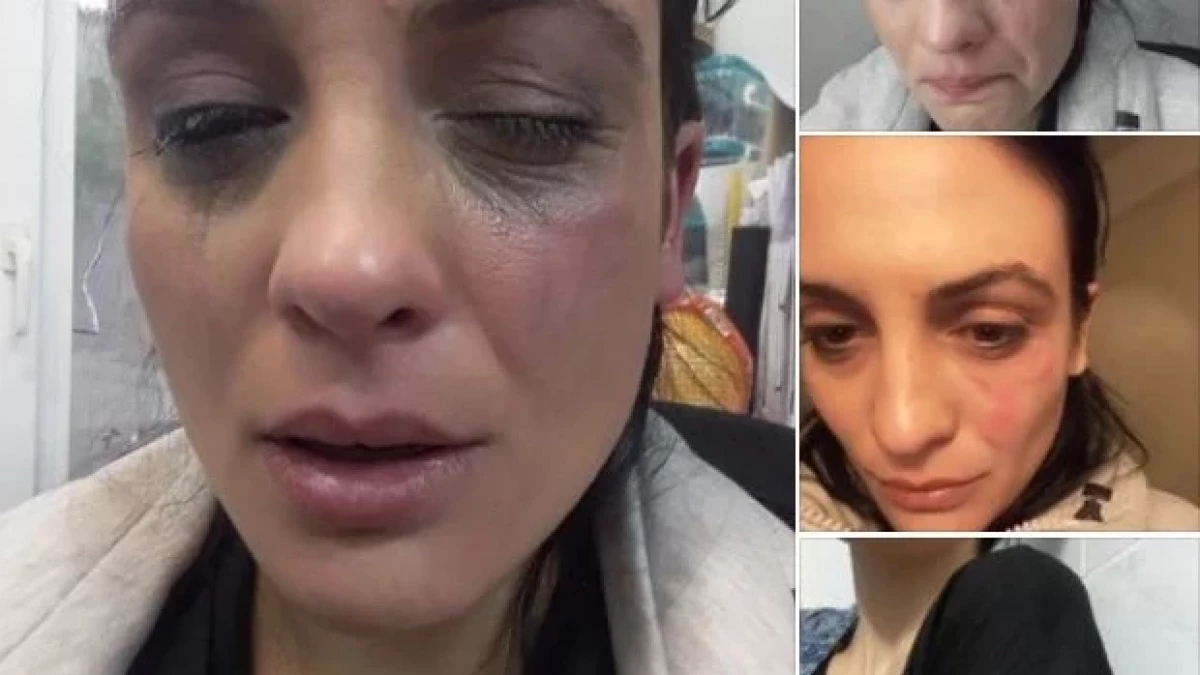 Диана Димирова призна: Лицето, което ме преби, продължава да ме заплашва