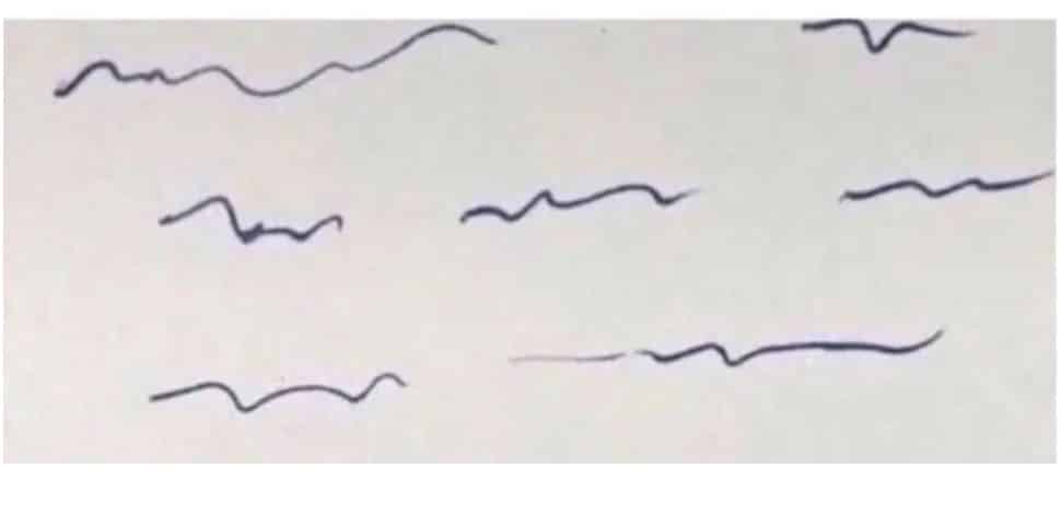 Графолог издаде тайните на нечетливия почерк след лекарите